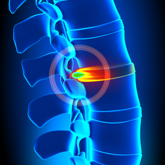 Disc Injuries and Prevention